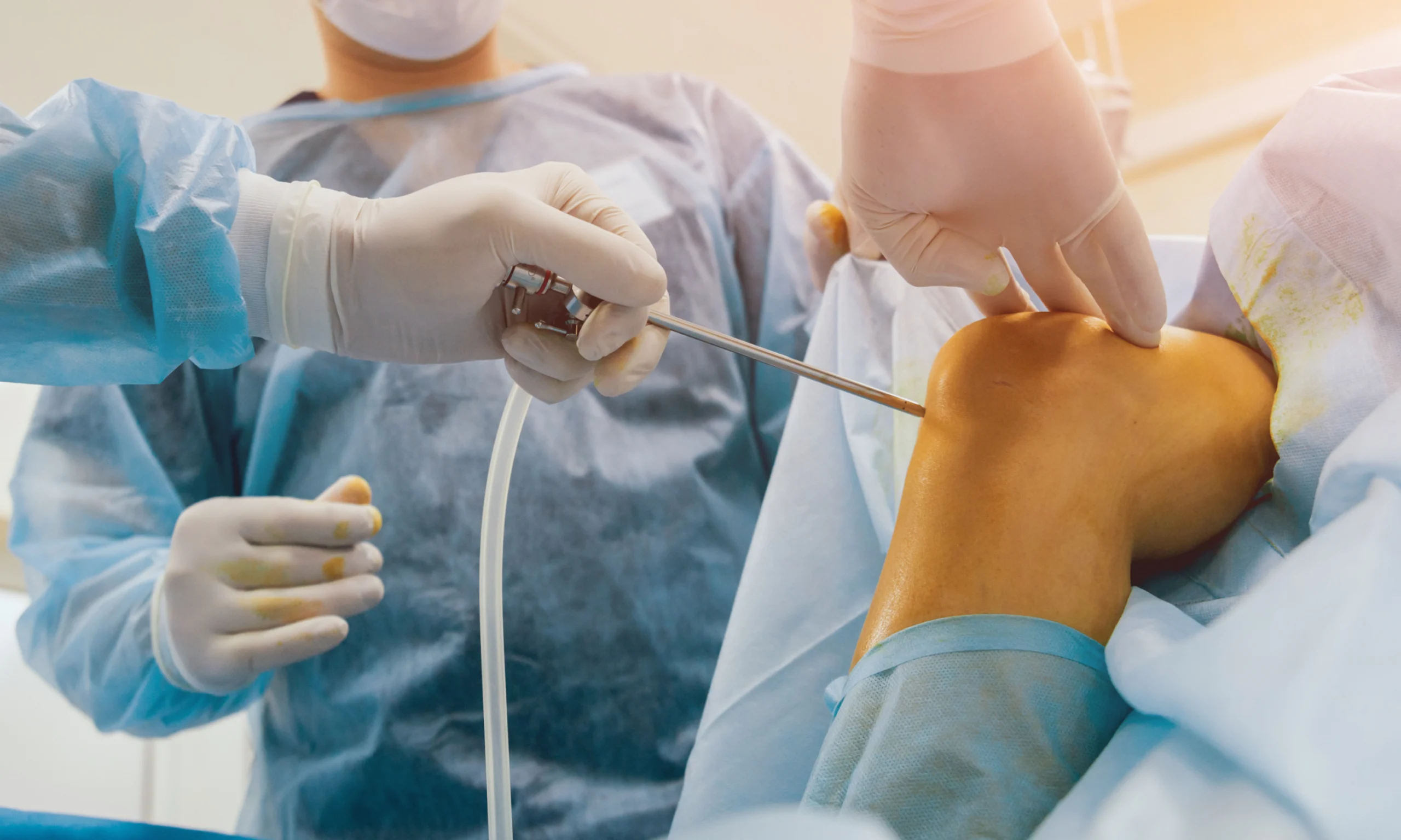 intervention genou scaled Conseils post-opératoires Dr Pierre SAUTET - Chirurgien orthopédiste Seine-Saint-Denis