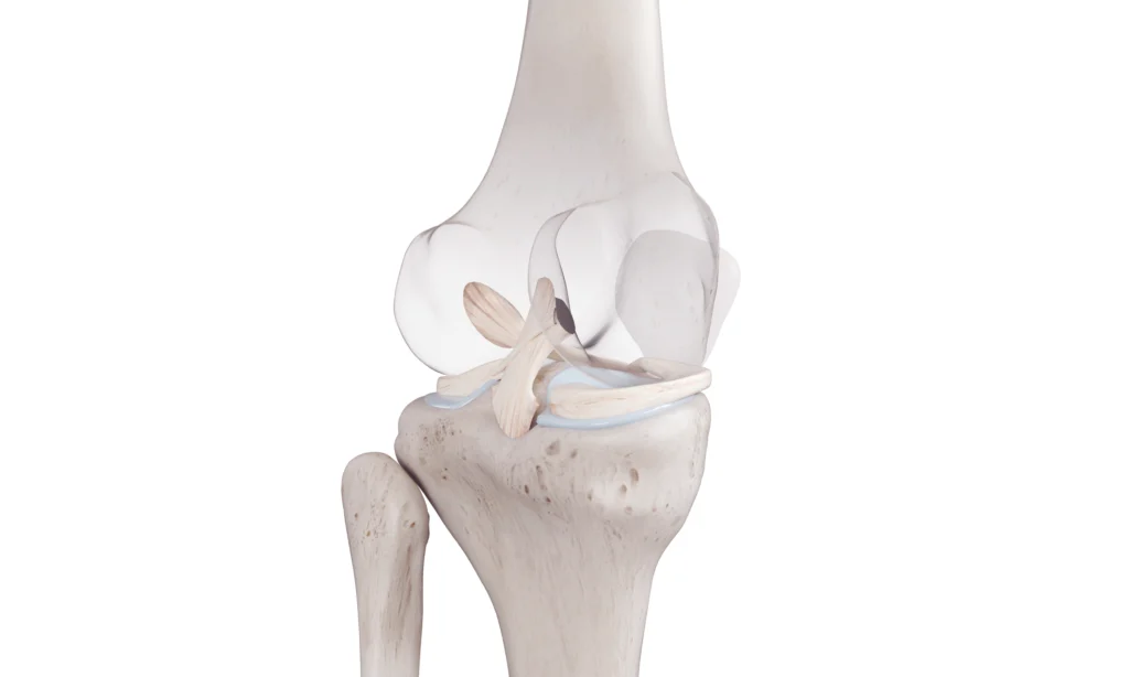 ligament crois anterieur genou x ligament crois anterieur genou x Traitements du genou Dr Pierre SAUTET - Chirurgien orthopédiste Seine-Saint-Denis