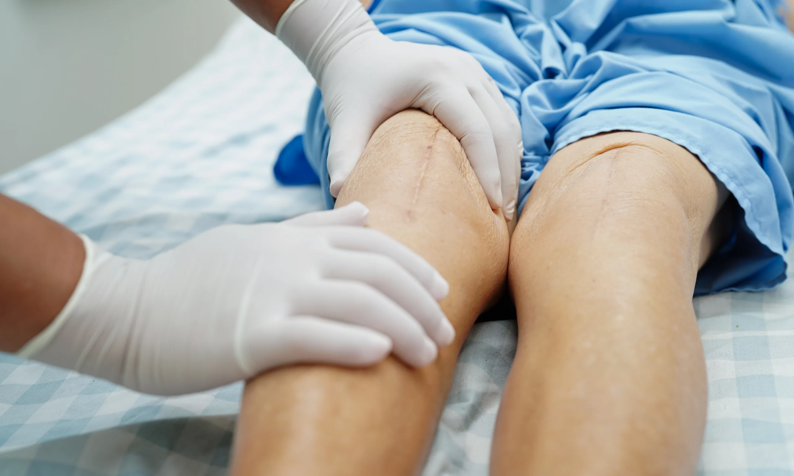 prothese genou orthopediste scaled prothese genou orthopediste scaled Nos techniques Dr Pierre SAUTET - Chirurgien orthopédiste Seine-Saint-Denis
