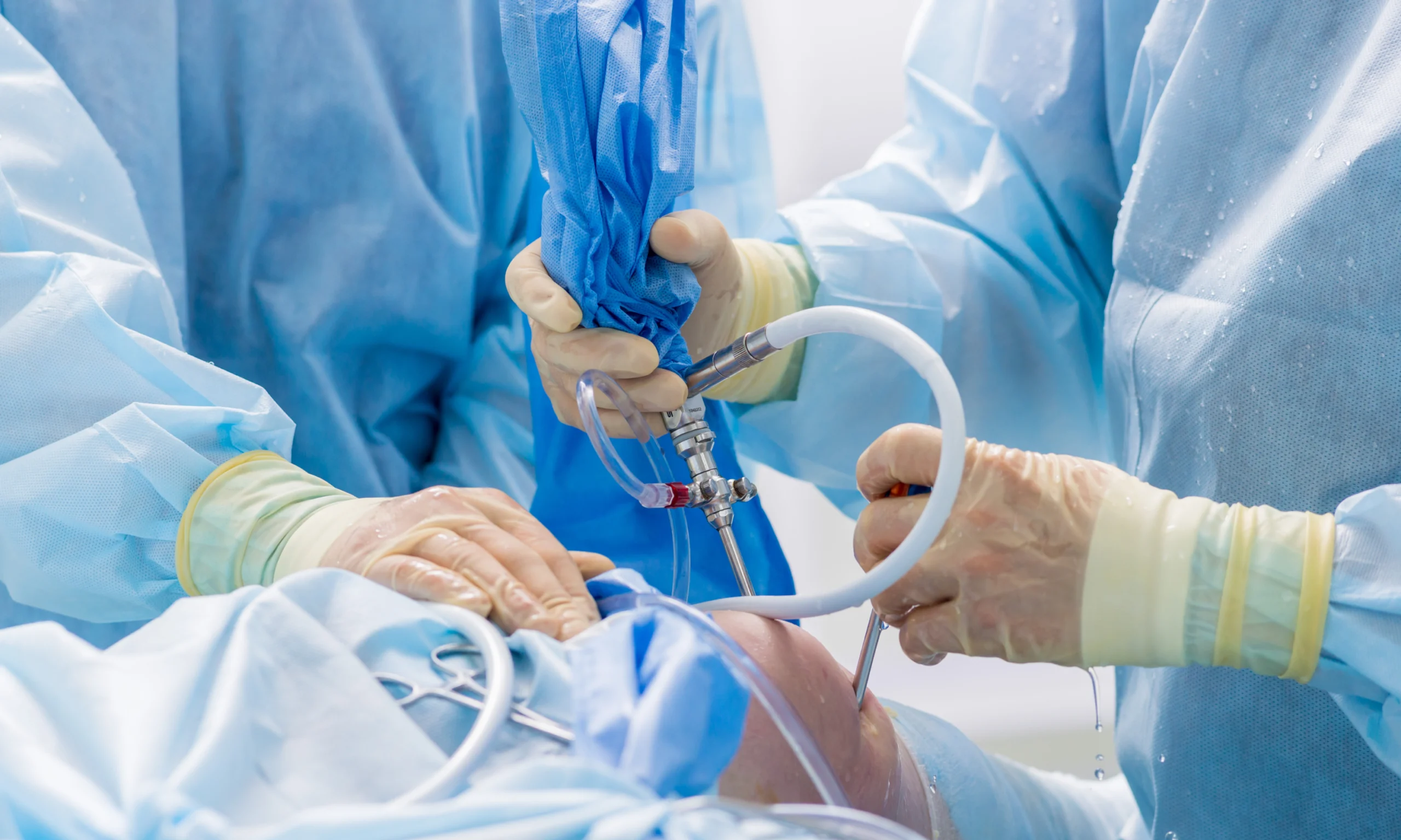 Chirurgie de prothèse du genou en bloc opératoire, Seine-Saint-Denis